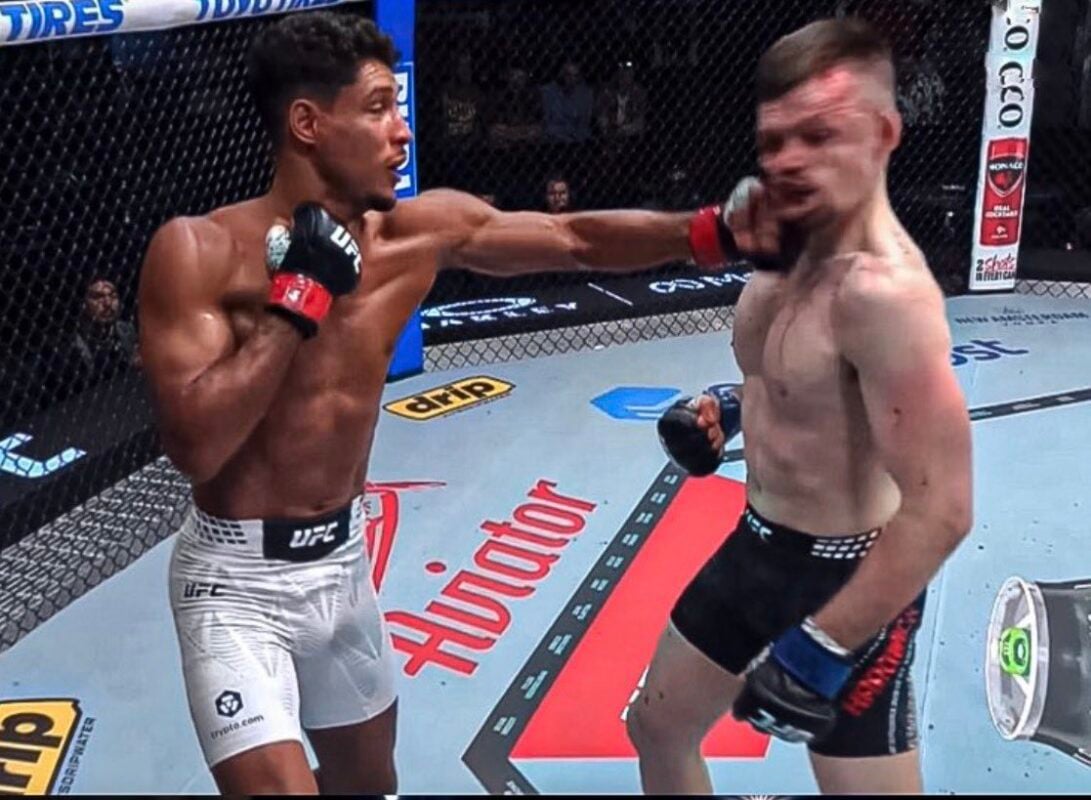 Harry Hardwick Shows Off Gruesome Broken Jaw: ‘Pretty F—king Dire’